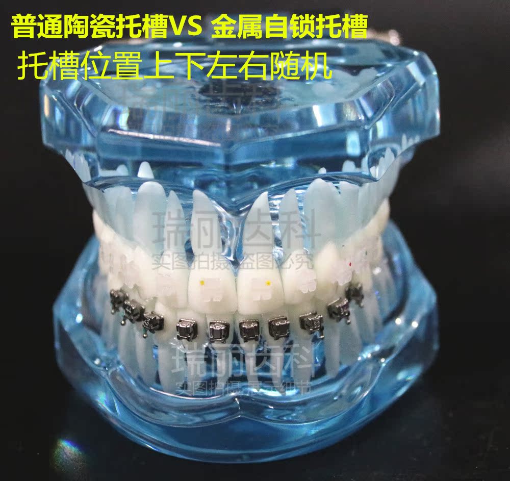 牙科2两种对比模型透明牙模陶瓷金属自锁牙齿模正畸医患沟通教学|msdalam kategori Toy/bayi/teka-teki/blok bangunan/model, model statik, mainan model lain - dari Buy2taobao.com untuk memberikan perkhidmatan ejen Taobao profesional membeli