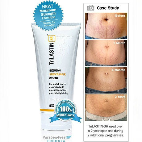 U.S.A TriLASTIN-SR Stretch marks/Obesity pattern nursing Cream 162mlin the Maternity/Maternal supplies/Nutrition , Maternal Care/Care/Qu Wen , Stretch marks Care category - from Buy2taobao.com to provide professional Taobao agent buy service