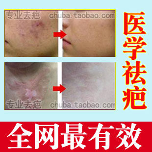 祛疤痕产品精油去疤痕烫伤凹凸手术伤疤剖腹产痘印修复膏正品中药