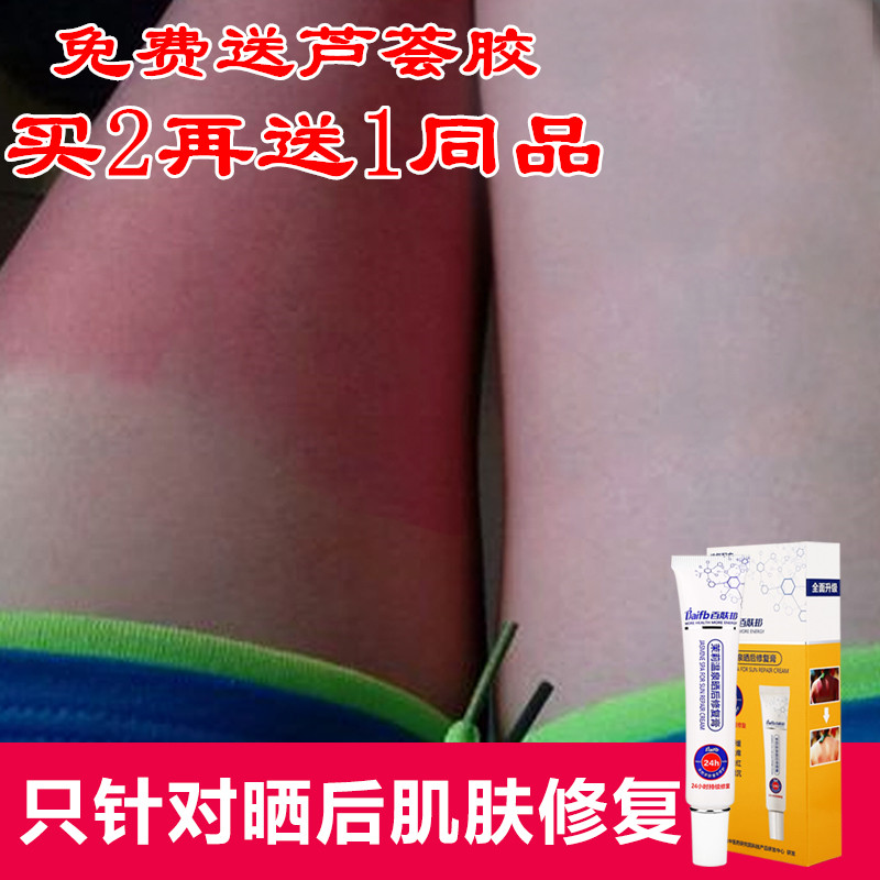 sunlight Sunburn Tan repair Peeling Repair Cream whole body skin Replenish water Relieve Stabilization men and womenin the Skin Care/Body/Essential oils , Emulsion/Cream category - from Buy2taobao.com to provide professional Taobao agent buy service