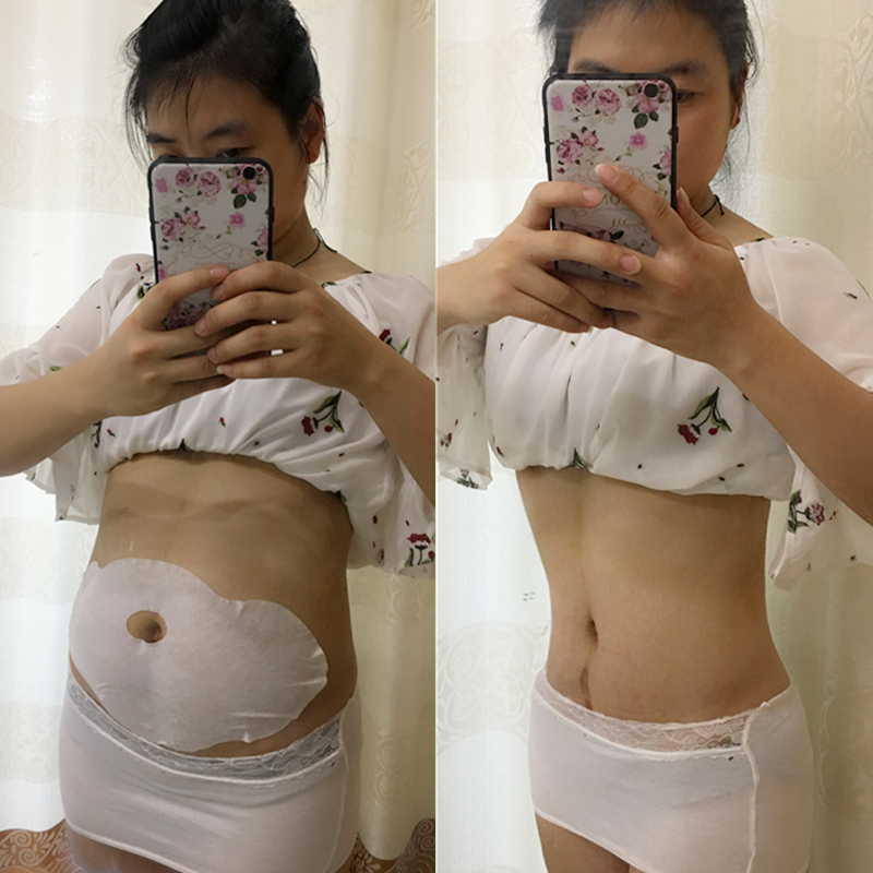 【買5送5】 小紅書推薦美肚變貼出來15天逆襲小腰精 點我讓妳變美在類目 個人護理/保健/按摩器材, 美體瘦身, 電動瘦腿帶/美腿儀中 - 來自Buy2taobao.com提供專業的淘寶代購服務