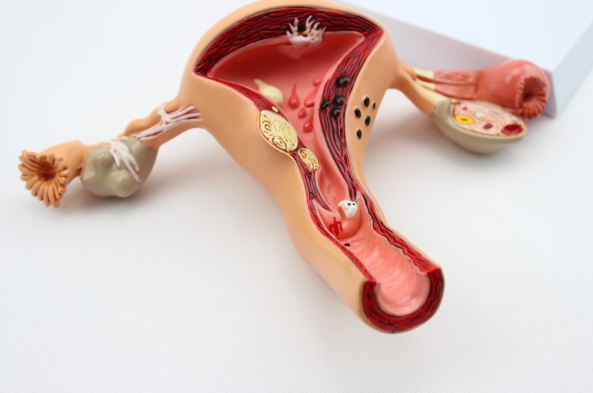 enovo正品 人体子宫 卵巢 阴道 病变模型 生殖科妇科医用演示模型