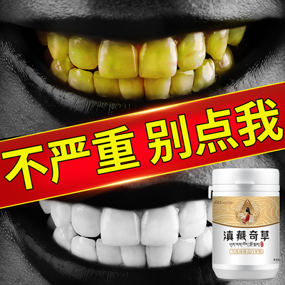洗牙粉非牙齿美白神器洁牙黄牙结石去烟渍男女牙渍口臭牙斑净
