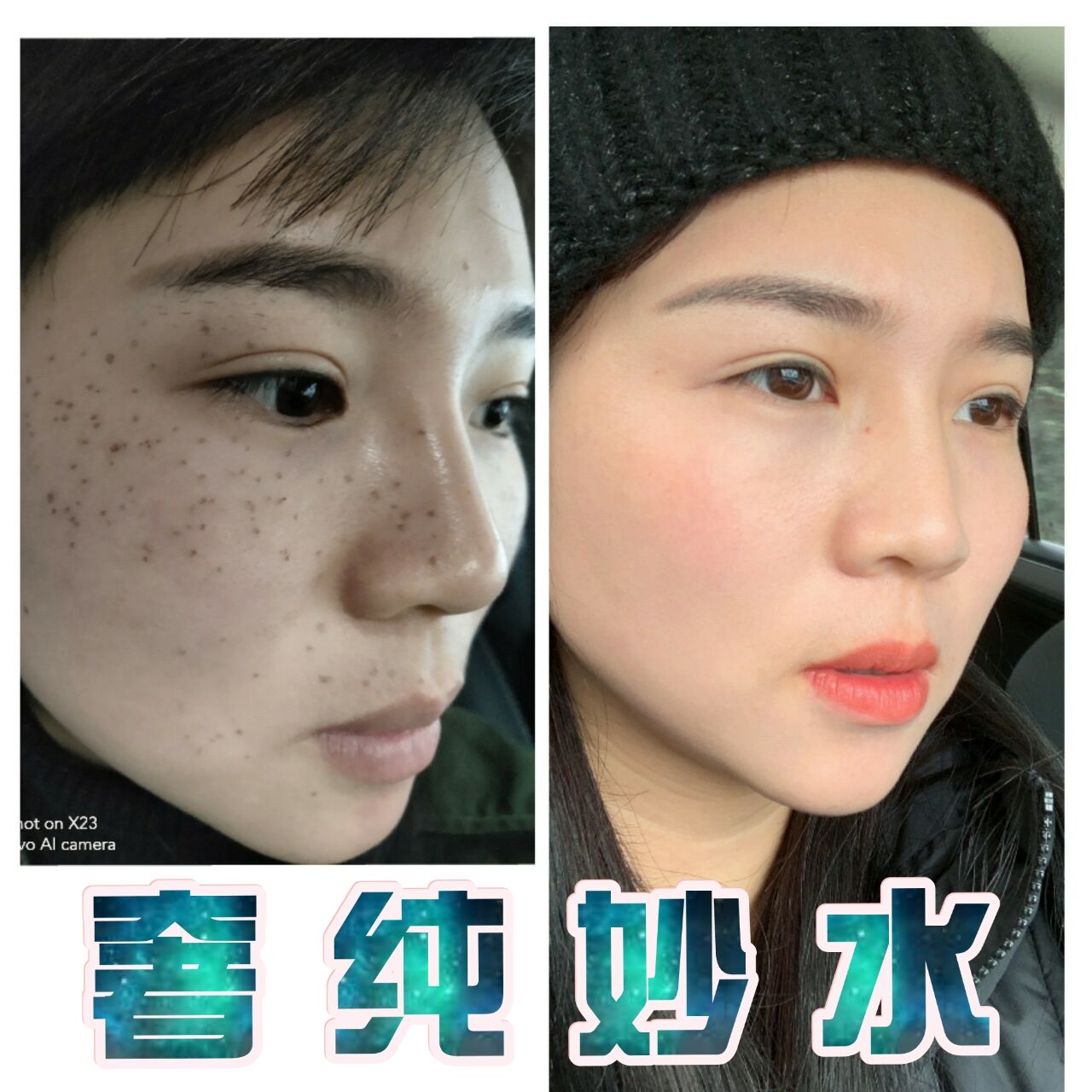 热卖精品奢纯妙水遗传性雀斑老年斑点状黄褐斑美容院专用产品包邮在类目 美容护肤/美体/精油, 面部护理套装中 - 来自Buy2taobao.com提供专业的淘宝代购服务