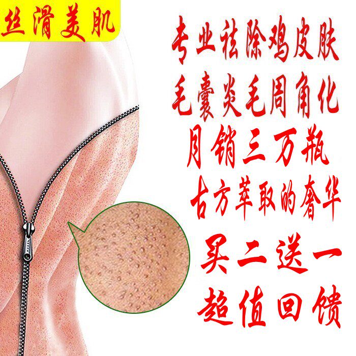 去鸡皮消疙瘩毛囊炎皮肤毛周角化症身体变光滑脂肪粒特效中药正品