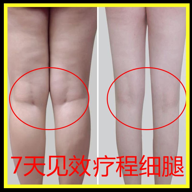 瘦腿神器抖音吴昕代言顽固型大腿小腿快速告别大象腿肌肉腿粗腿。|ruв категории личный уход/Здравоохранение/массажное оборудование, красоты/Body вспомогательные инструменты, нос выше устройство - от Buy2taobao.com для оказания профессиональной услуги покупки агента Taobao