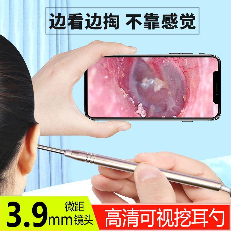 掏耳神器可视挖耳勺发光带灯采耳朵扣耳屎儿童采耳工具套装内窥。|ruв категории семья/личные чистящие средства, потребительских уборка посуды, ухочистка - от Buy2taobao.com для оказания профессиональной услуги покупки агента Taobao
