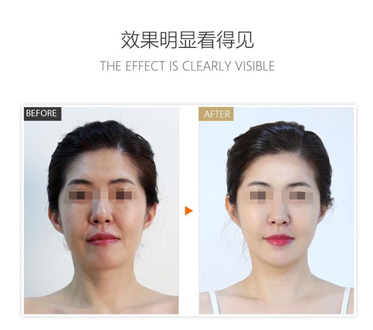 抗衰寡肽补水去眼袋蛋白肽李湘代言黄金线雕整形医院美容院专用在类目 个人护理/保健/按摩器材, 清洁美容工具, 电子美容仪中 - 来自Buy2taobao.com提供专业的淘宝代购服务