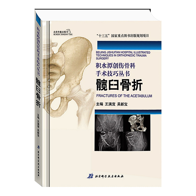 现货包邮 积水潭创伤骨科手术技巧 髋臼骨折 骨盆与髋臼骨折骨科学骨科手术学骨科护理学骨科手术图谱骨科手术入路技术外科骨科|ruв категории книги/журнал/газета, медицинского здравоохранения, медицины других - от Buy2taobao.com для оказания профессиональной услуги покупки агента Taobao