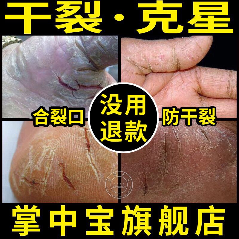 滋润肤面霜手霜防裂膏补水保湿乳皮肤干燥粗糙手脚干裂开裂在类目 洗护清洁剂/卫生巾/纸/香薰, 洗发沐浴/个人清洁, 身体护理, 护手霜中 - 来自Buy2taobao.com提供专业的淘宝代购服务