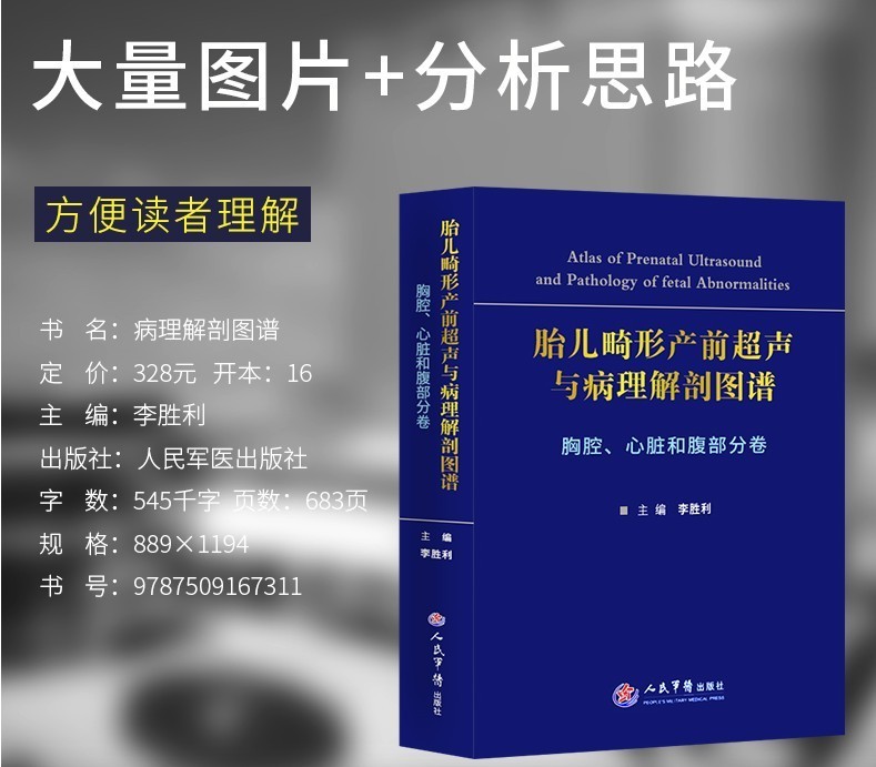 胎兒畸形産前超聲與病理解剖圖譜 胸腔心髒和腹部分卷 李勝利 人民軍醫 超聲醫學 影像醫學 醫學解剖圖譜 臨床診斷與鑒定 醫學書籍在類目 書籍/雜誌/報紙, 醫學衛生, 醫學其它中 - 來自Buy2taobao.com提供專業的淘寶代購服務