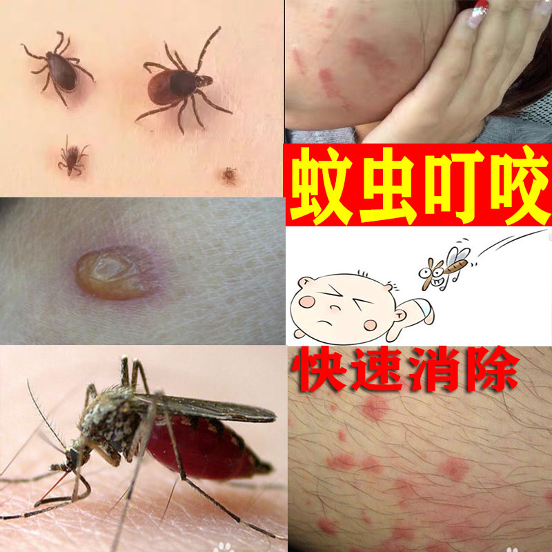 泰国青草膏蚊虫叮咬止痒消肿膏大人婴儿儿童木瓜膏修复膏凝胶药在类目 尿片/洗护/喂哺/推车床, 驱蚊退烧用品, 止痒膏中 - 来自Buy2taobao.com提供专业的淘宝代购服务