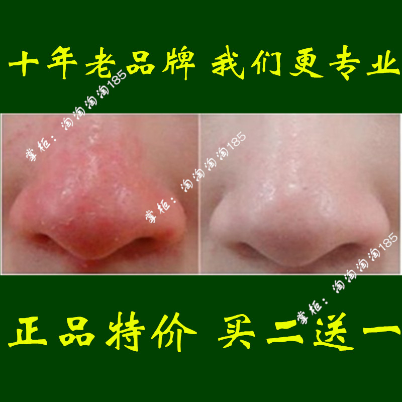 去除酒糟鼻治疗液修复凝胶红鼻子特效正品螨虫药酒渣鼻鼻螨清软膏在类目 宠物/宠物食品及用品, 马类及其用品, 马匹保健护理中 - 来自Buy2taobao.com提供专业的淘宝代购服务
