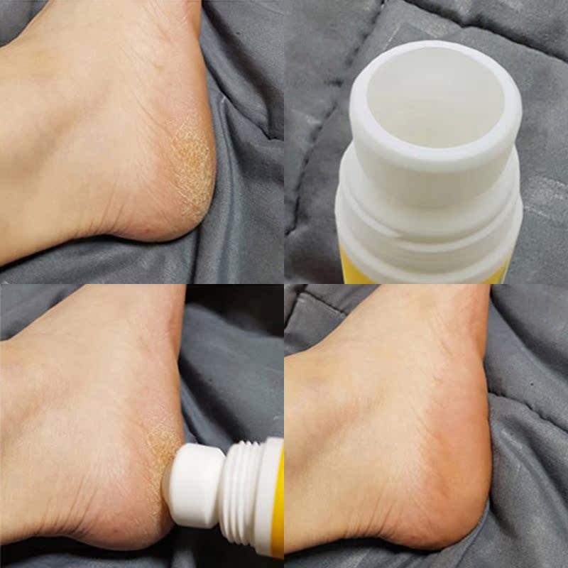[the republic of korea Foot Artifact Exfoliating foot Pedicure Calluses Scraping foot knife Foot stonein the Family/Personal Cleaning Tools , Personal care cleaning appliances , Rub feet/Brush feet/Foot stone category - from Buy2taobao.com to provide professional Taobao agent buy service