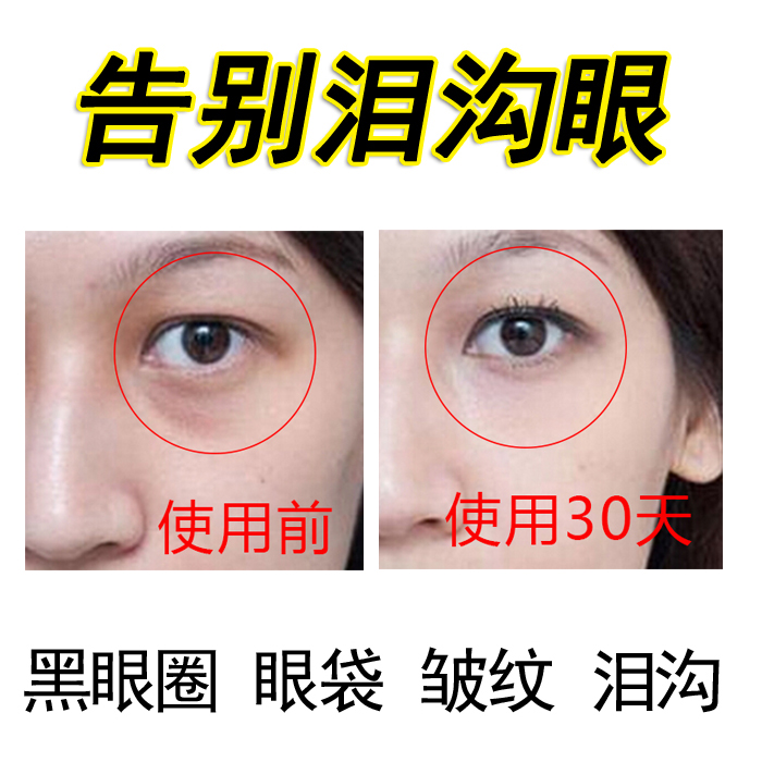 祛除淚溝眼去黑眼圈眼袋眼睛護理填充眼窩豐淚溝臥蠶精華男女神器在類目 美容護膚/美體/精油, 眼部護理(新), 眼部精華中 - 來自Buy2taobao.com提供專業的淘寶代購服務