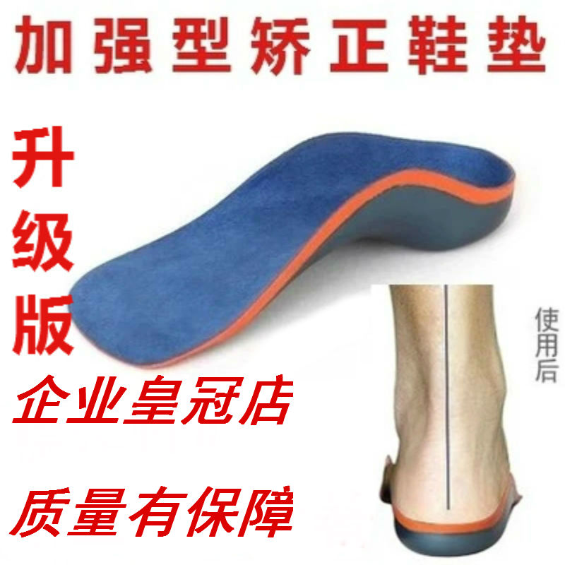 儿童矫正鞋垫 孩子走路内八字踮脚X型腿纠正宝宝足外翻扁平足矫形|ruв категории Аксессуары, сумки и обувь/аксессуары для ремня, обувь, аксессуары, стелька - от Buy2taobao.com для оказания профессиональной услуги покупки агента Taobao