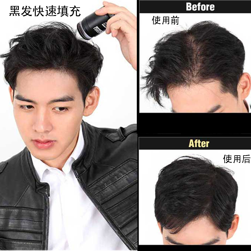 DASHU the republic of korea Male hair Filling black air cushion Hairline Temple waterproof Windbreak Reissue Tonerin the Hair Care/Wig , Hair Styling category - from Buy2taobao.com to provide professional Taobao agent buy service