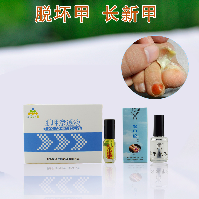 灰指甲厚甲脱呷渗透液甲精油抑菌液专用药软膏工具套装外用冰醋酸在类目 家庭/个人清洁工具, 个人洗护清洁用具, 指甲刀/指甲钳, 美甲/修甲套装中 - 来自Buy2taobao.com提供专业的淘宝代购服务