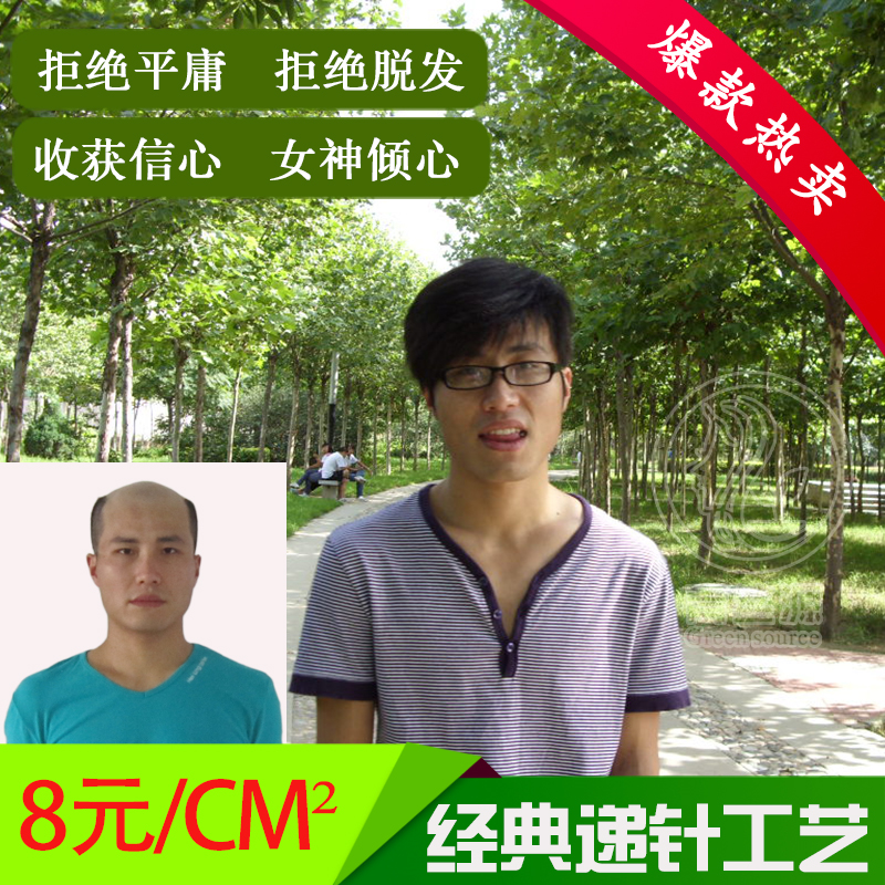 Black hair brand No trace Shading Reissue Additional issue Real wig Toupee Solve Alopecia annoyancein the Hair Care/Wig , Wig , Straight hair piece category - from Buy2taobao.com to provide professional Taobao agent buy service