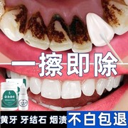 洗牙粉去黄洗白去口臭美白速效黄牙洗牙齿，污垢除牙石烟渍牙垢神器