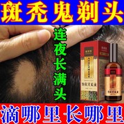 儿童斑秃生发液鬼剃头药生发增发密发防脱发掉发快速生发剂育发液