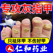 仁和去灰指甲药膏治疗专用药的药皮肤病脚气真菌感染4