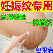 去妊辰纹消除去妊娠纹，产后紧致修护淡化去疤膏，男女去肥胖纹修复霜