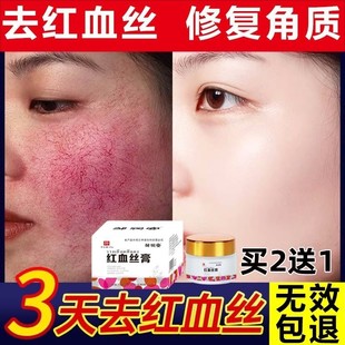 红血丝修复去除脸部角质层薄修复敏感肌肤泛，红淡化大红脸专用面霜