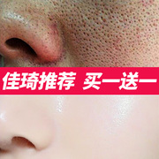 收毛孔粗大修复去粉刺闭口湿敷水收缩祛黑头螨虫救星男士女护肤品