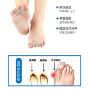 定制日本进口大拇指外翻脚趾矫正器重叠趾头纠正矫形大脚骨分趾器