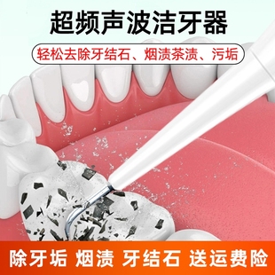 超声波洁牙器牙结石牙垢去除器牙齿美白洗牙神器美牙仪口腔镜清除