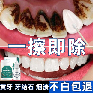洗牙粉去黄洗白去口臭美白速效，黄牙洗牙齿，污垢除牙石烟渍清洁神器