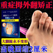 大指姆外翻贴专攻大脚趾变形穿鞋疼痛肿大专用贴