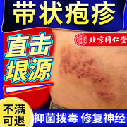 带状疱疹后遗症神经痛特效外用止痛蛇盘疮疼泡疹蛇缠腰止痒药膏ro