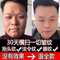 除皱纹神器去抬头纹祛皱男抗皱提拉紧致面霜男士去皱抗衰老护肤品