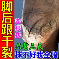 脚后跟开裂药膏手脚干裂脱皮真菌，专用感染脚底干燥皲裂修复药膏