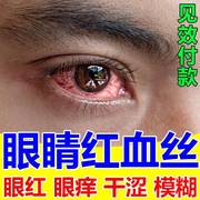 眼睛红血丝修复去除结石，去黄去红血丝缓解眼，抗疲劳眼药水粘稠滴液
