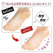 日本足部死皮b002oeg7老茧刮去脚脚棒脚跟去修护理角质修脚磨