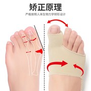 拇指外翻矫正器女士大脚骨分趾器大拇指纠正可以穿鞋母脚趾矫正器