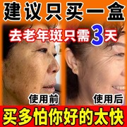 老年斑强力去除手部脸部去斑专用老人祛斑霜祛黄褐斑雀斑