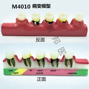牙齿模型口腔教学模型带神经牙模正畸模牙科，模型种植模型修复模型
