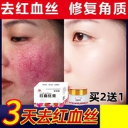 红血丝修复去除脸部角质层薄修复敏感肌肤泛红淡化大红脸专用面霜