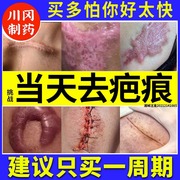 日本进口疤克祛疤膏，巴克去疤痕修复除疤膏儿童烫伤