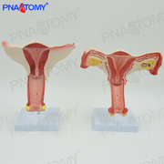 女性内生殖器系统子宫卵巢输卵管解剖模型医用教学妇科产科教具