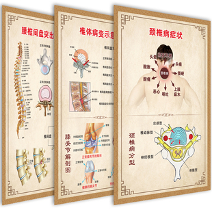 颈椎腰椎间盘突出海报挂图骨病椎体病变图症状调理脊椎全息图墙贴