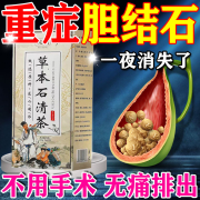 结石康胶囊胆结石溶石化石金钱草中药，专用特效茶治疗胆囊炎肾结石