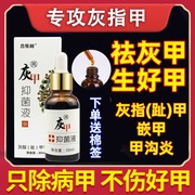 灰指甲治疗专用药水根治抑菌液手指甲脚趾甲亮甲抗真菌特效药去根甲沟炎特效药膏指甲往肉里长黑指甲修复液受损再生