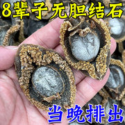 胆结石溶石化石排石茶治疗肾结石鸡内金石清茶特效药金钱草中药贴