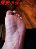 脚底板发白脚气红穆大夫足跟，干裂药膏脚后跟护理膏手裂脚裂皮肤粗