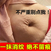 妊辰纹消除去妊娠纹紧致肚皮淡化肥胖纹修复霜，产后消除疤痕除疤膏